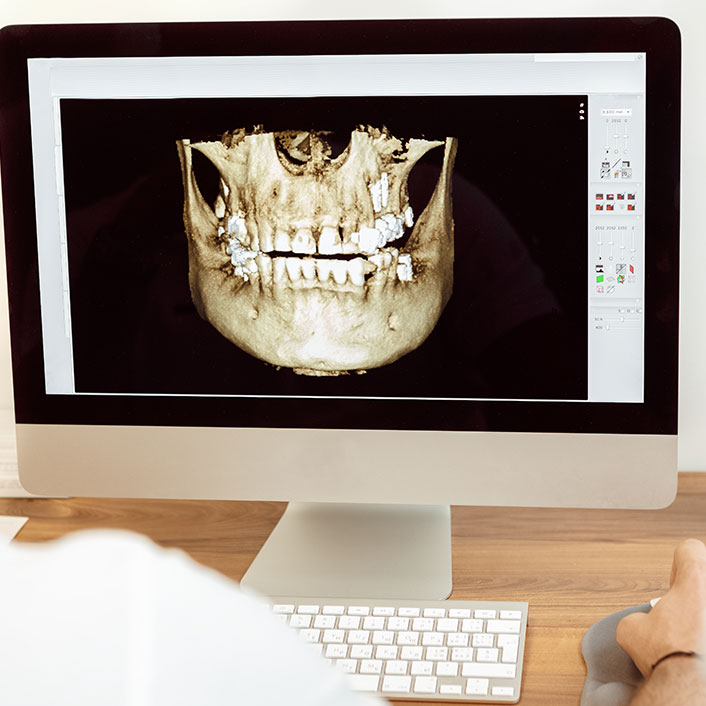 Cone Beam - Dental Technology